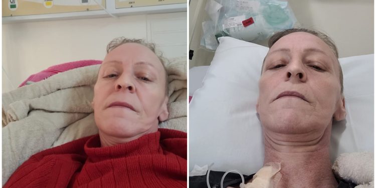 Moradora de Jaraguá do Sul luta contra câncer pulmonar e de mama e busca ajuda