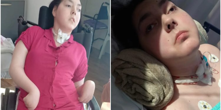 Família de adolescente de Schroeder pede ajuda para custear tratamento e aparelho respiratório