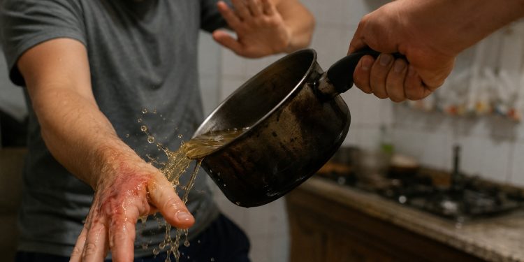 Irmãos brigam e um sofre queimaduras após ser atingido por panela com banha quente, em Jaraguá do Sul