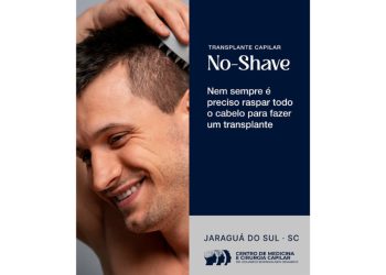 No-Shave: Nem sempre é preciso raspar todo cabelo para fazer implante