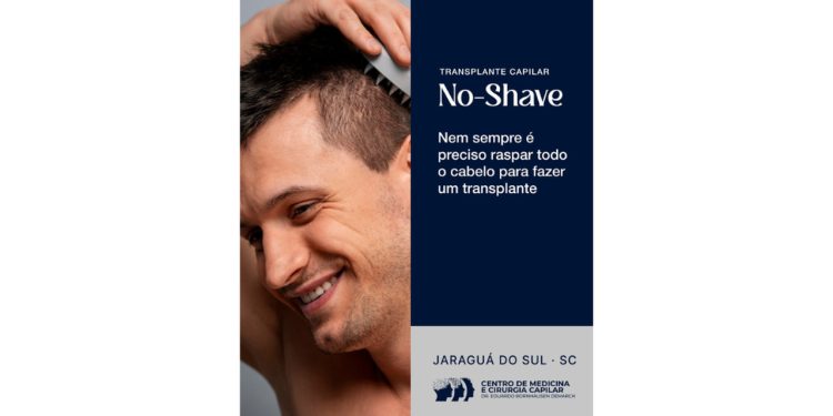 No-Shave: Nem sempre é preciso raspar todo cabelo para fazer implante